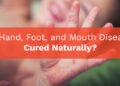 Is Hand, Foot, and Mouth Disease Cured Naturally?