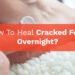 How To Heal Cracked Feet Overnight?